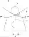 Fig. 01 - Slot die coating device having air vent