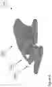 Fig. 07 - Latching mechanism for suppository mold