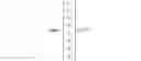 Fig. 04 - Road surface recognition apparatus, vehicle having the same, and method of controlling vehicle