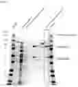 Fig. 02 - Botulinum toxin producing method