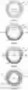 Fig. 04 - Interlocking two-part sewing needle for double loop stitching