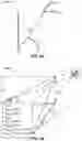 Fig. 14 - Earthquake protection systems, methods and apparatus using shape memory alloy (SMA)-based superelasticity-assisted slider (SSS)