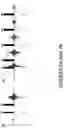 Fig. 08 - NMR DETECTION OF COAGULATION TIME