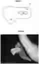 Fig. 02 - Hand-held tool