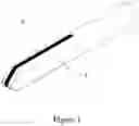 Fig. 02 - Method for characterization of the female pelvic floor with a biomechanical integrity score