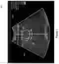 Fig. 02 - Predictive use of quantitative imaging