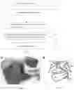Fig. 03 - Method for measuring parameters in ultrasonic image and ultrasonic imaging system