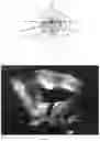Fig. 04 - Method for measuring parameters in ultrasonic image and ultrasonic imaging system