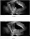 Fig. 09 - Method for measuring parameters in ultrasonic image and ultrasonic imaging system