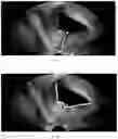 Fig. 10 - Method for measuring parameters in ultrasonic image and ultrasonic imaging system