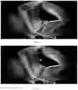 Fig. 11 - Method for measuring parameters in ultrasonic image and ultrasonic imaging system