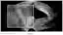 Fig. 14 - Method for measuring parameters in ultrasonic image and ultrasonic imaging system