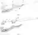 Fig. 02 - Biopsy needle and puncture biopsy device