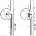 Fig. 08 - Devices for treating vascular malformations