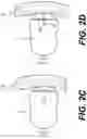 Fig. 05 - PERCUTANEOUS RETROGRADE THERAPY FOR PULMONARY EMBOLISM