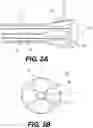 Fig. 06 - PERCUTANEOUS RETROGRADE THERAPY FOR PULMONARY EMBOLISM