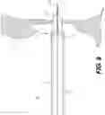 Fig. 10 - PERCUTANEOUS RETROGRADE THERAPY FOR PULMONARY EMBOLISM