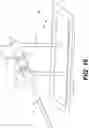 Fig. 16 - PERCUTANEOUS RETROGRADE THERAPY FOR PULMONARY EMBOLISM