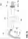 Fig. 19 - PERCUTANEOUS RETROGRADE THERAPY FOR PULMONARY EMBOLISM