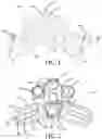 Fig. 02 - Occipital plates and related methods