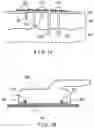 Fig. 02 - Method and apparatus for skin stabilization and positioning