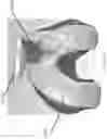 Fig. 167 - Patient-Adapted and Improved Articular Implants, Designs and Related Guide Tools
