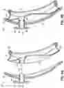 Fig. 05 - MICTURITION DEVICE