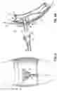 Fig. 06 - MICTURITION DEVICE