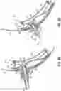 Fig. 07 - MICTURITION DEVICE