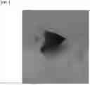 Fig. 02 - Targeting microbubbles