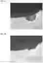 Fig. 05 - Targeting microbubbles