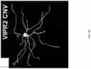 Fig. 49 - HUMANIZED VIPR2 COPY NUMBER VARIANT TRANSGENIC MOUSE MODEL FOR ANTIPSYCHOTIC DRUG AND GENE THERAPY DISCOVERY FOR SCHIZOPHRENIA