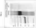 Fig. 09 - MODIFIED BACULOVIRUS SYSTEM FOR IMPROVED PRODUCTION OF CLOSED-ENDED DNA (ceDNA)
