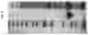 Fig. 05 - Method for the in vivo synthesis of 4-hydroxymethylfurfural and derivatives thereof