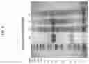 Fig. 09 - Method for the in vivo synthesis of 4-hydroxymethylfurfural and derivatives thereof