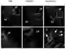 Fig. 01 - NANOVESICLES DERIVED FROM BACTERIA OF GENUS DEINOCOCCUS, AND USE THEREOF