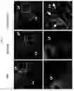Fig. 04 - NANOVESICLES DERIVED FROM BACTERIA OF GENUS DEINOCOCCUS, AND USE THEREOF