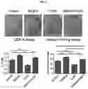 Fig. 06 - Analysis method and kit for diagnosis of urolithiasis