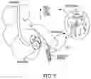Fig. 07 - Blood biomarkers for appendicitis and diagnostics methods using biomarkers