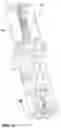Fig. 10 - Railroad spike remover
