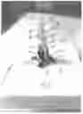 Fig. 09 - WALL ANCHOR WITH DEFORMABLE EXPANDABLE PART