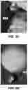 Fig. 07 - APPARATUS FOR STORING A LIGHTER FOR A JAR CANDLE AND METHOD OF USE