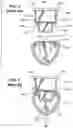 Fig. 03 - Connector system for lighting assembly