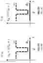Fig. 11 - Systems and methods for automatic visual inspection of defects in ophthalmic lenses