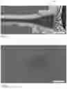 Fig. 20 - Method of Detecting an Infection Using Negative Sorting
