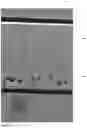 Fig. 26 - Method of Detecting an Infection Using Negative Sorting