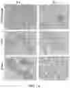 Fig. 02 - CANCER DETECTION UTILIZING NORMAL TISSUE ADJACENT TO BREAST TUMORS WITH GENETIC ANCESTRY-MAPPING