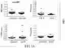 Fig. 16 - CANCER DETECTION UTILIZING NORMAL TISSUE ADJACENT TO BREAST TUMORS WITH GENETIC ANCESTRY-MAPPING