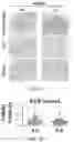 Fig. 19 - CANCER DETECTION UTILIZING NORMAL TISSUE ADJACENT TO BREAST TUMORS WITH GENETIC ANCESTRY-MAPPING