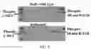 Fig. 24 - CANCER DETECTION UTILIZING NORMAL TISSUE ADJACENT TO BREAST TUMORS WITH GENETIC ANCESTRY-MAPPING